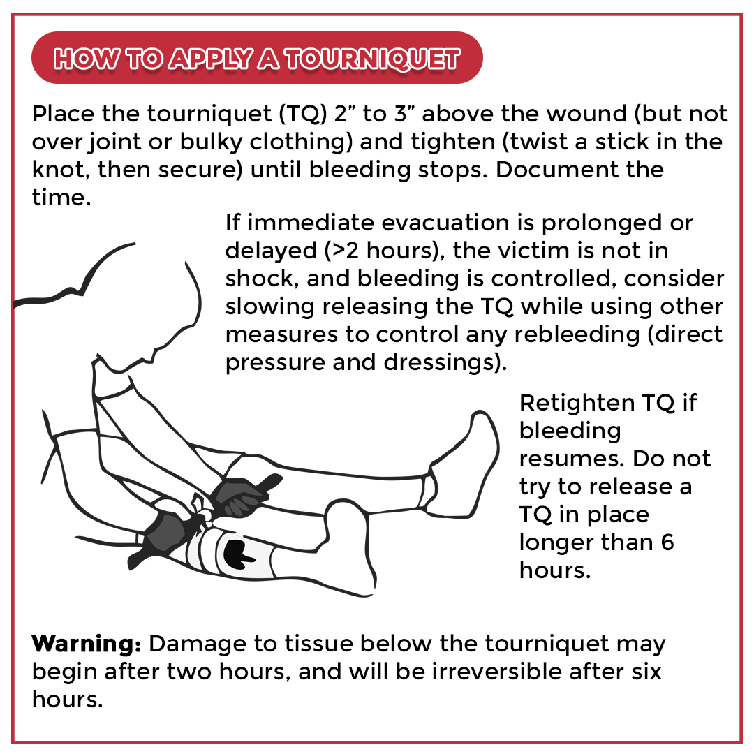 how to apply a tourniquet
