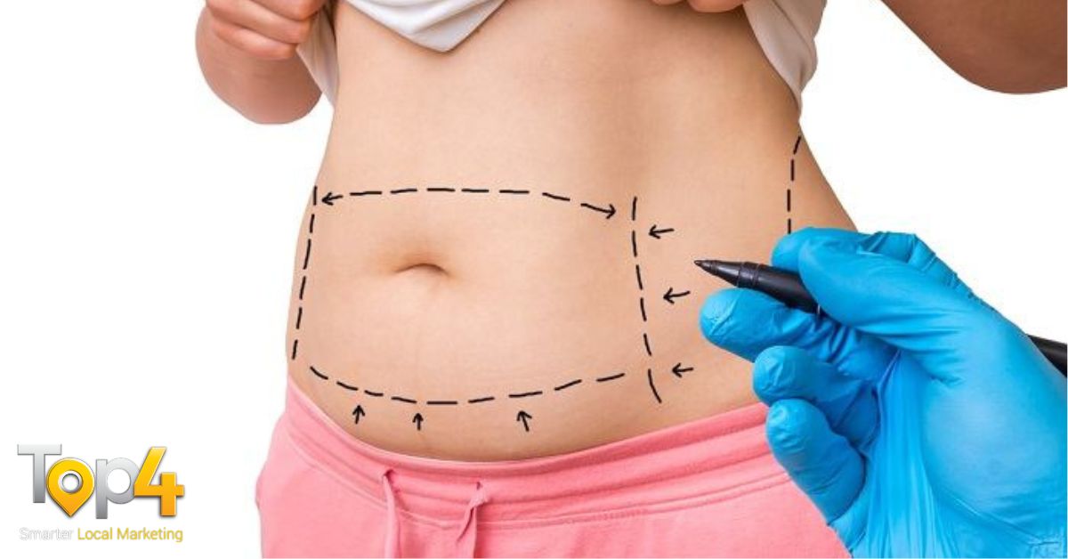 Cosmetic Surgery To Help Reshape Your Body - Top4
