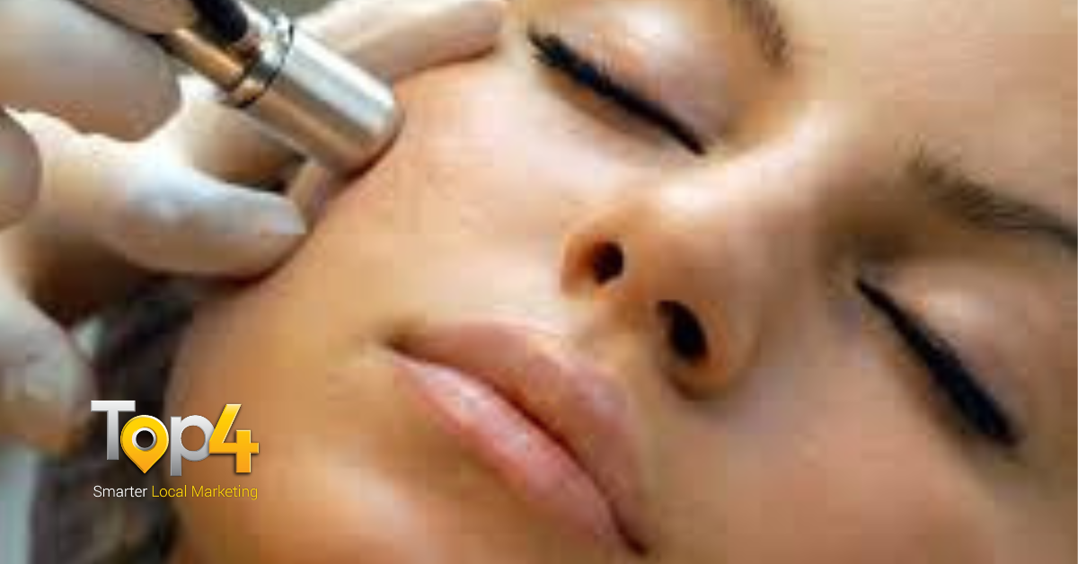 Microdermabrasion-the Advantages